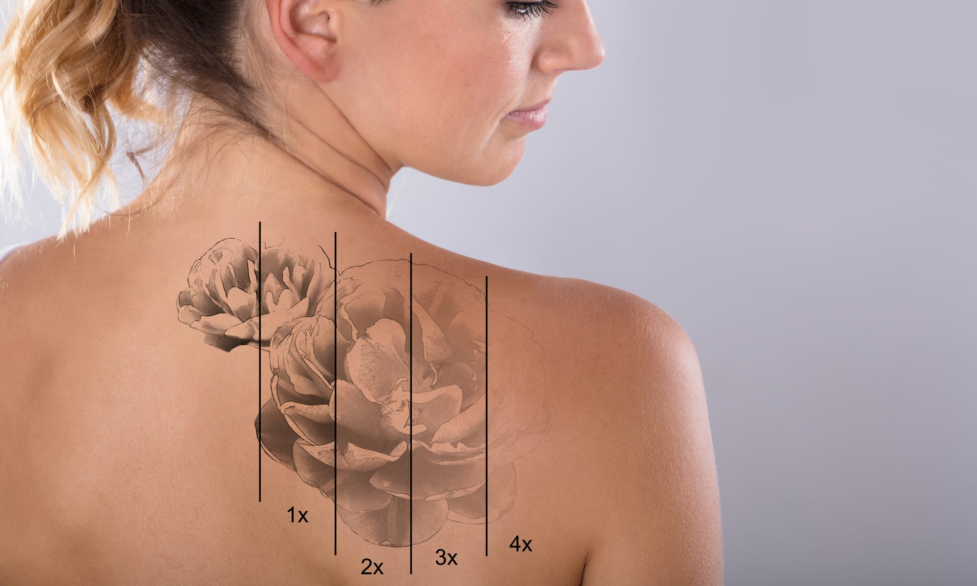 TattooRemovalReno.com